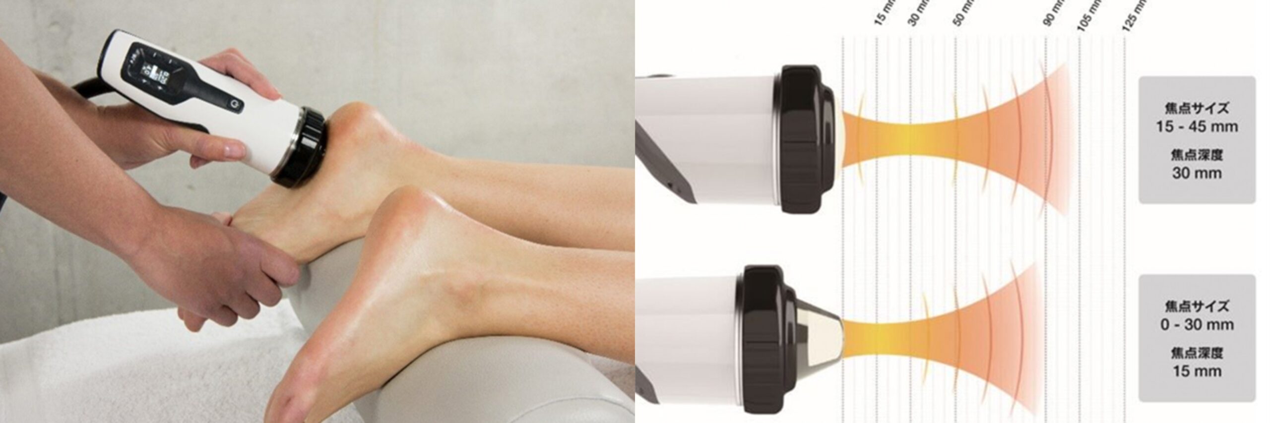 靱帯性関節ストレイン-オステオパシー・マニピュレーション 2018.01  